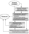 Лечение острого геморроя