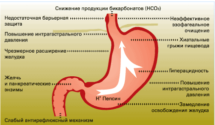 ожирение и гэрб