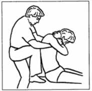 Иммобилизация (замыкание) и прицельная манипуляция на грудном отделе позвоночника с помощью колена в положении больного сидя.