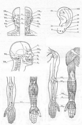 Самые эффективные точки для акупрессурного лечения неврита лицевого нерва