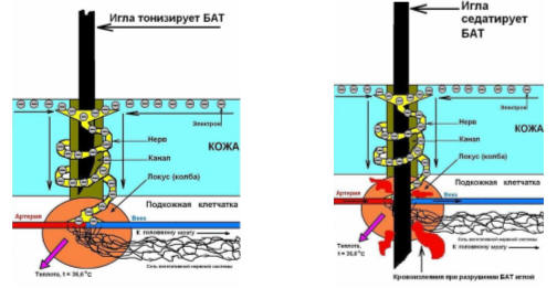 Механизм тонизации и седатации точки акупунктуры (БАТ).