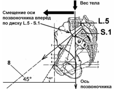 Расположение межпозвоночного диска L.5 – S.1 под углом 45 ° по отношению к горизонтальной линии (у стоящего человека).
