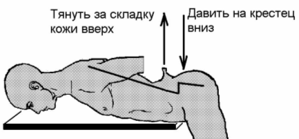 Позвоночник в зоне L.5 - S.1 искривляет свою ось в виде «лестницы». Манипуляция выравнивания оси позвоночника при помощи тракции позвонка L.5 за складку кожи и одновременного давления на крестец.