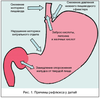 Боли в спине центр поясницы