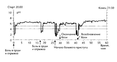 . 2.            4 ( .., 2000). 