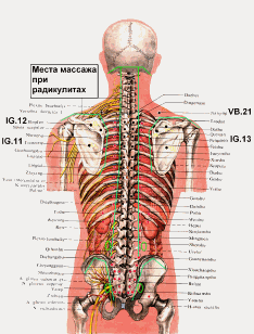 Европейский массаж. Основные места массажа при радикулите (очерчены зелёной линией)