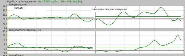 . 4.  Pi/Ps ,      