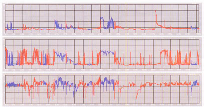 . 1.  . -   .      1,8.  :  De Meester 10,22,   <4 3%.