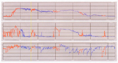 . 2.  . -:   .      4,1.  :  De Meester 6,07;   <4 2%.