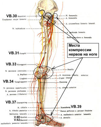 Рисунок 19. Места компрессии нервов на ноге.