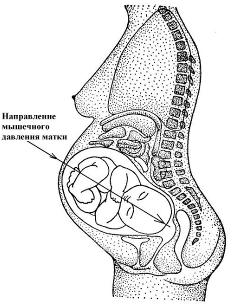 Рисунок 1. Направление давления мощных мышц матки на позвоночник ребёнка – от ягодиц к голове.