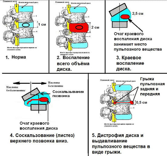  1 - 1, 2, 3, 4, 5.    :    (2),   (3), - (4),     (5).