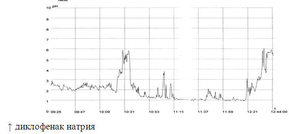 Положительная проба с диклофенаком натрия у больного А., 28 л. (РА)