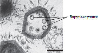 Рис. 2. Маленькие вирусы-спутники (как считают – паразиты) внутри гигантского мимивируса. Длина масштабной линейки— 200нм.[2] 