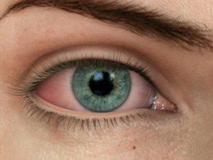 Американские ученые выяснили, как проблемы с глазами связаны с памятью