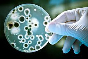 Бытовая химия способствует распространению устойчивых к антибиотикам бактерий