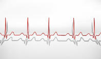 причины и симптомы инфаркта миокарда