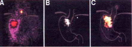 . 2.    99     ;    111l     ;       (Kahnilas P. et al., 2013) 