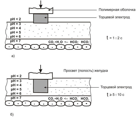 Рис.30 Схема измерения кислотности рН-зондом с торцевым сурьмяным электродом: а) при первом касательном контакте торца электрода со слизистой оболочкой; б) при умеренном надавливании рН-зондом в течение более длительного времени.