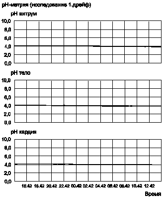 . 13      -      4,02   37ºC.