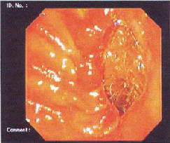 . 4. -      II ( . . Vereetal., 2005 [56])