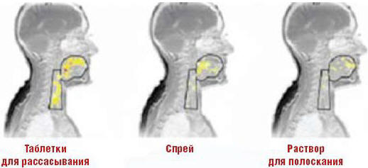 Рис. 2. Распределение активного вещества в полости рта и глотки через 30 мин после приема