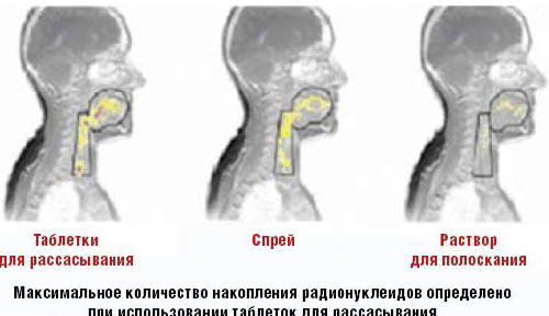 Рис. 1. Распределение активного вещества в полости рта и глотки через 6 мин после приема