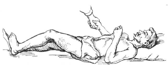 Рис. 11. Глобальная синкинезия