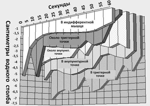Рис. 29. Динамика внутритканевого давления в триггерных и акупунктурных точках, а также в индифферентной мышечной ткани