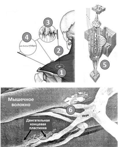 Рис. 31. Электрогенез триггерных точек
