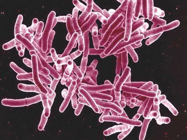 Российские биологи установили: туберкулез выживает за счет ресурсов человека
