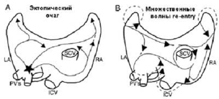 Основные электрофизиологические механизмы ФП