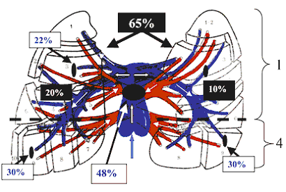 Частота локализации тромбоэмболов в системе легочной артерии