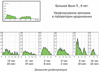 Урофлоуметрия норма у мужчин по возрасту таблица